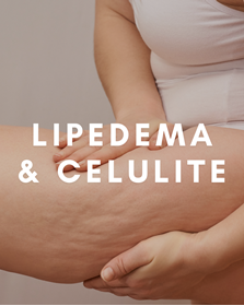 Lipedema e Celulite